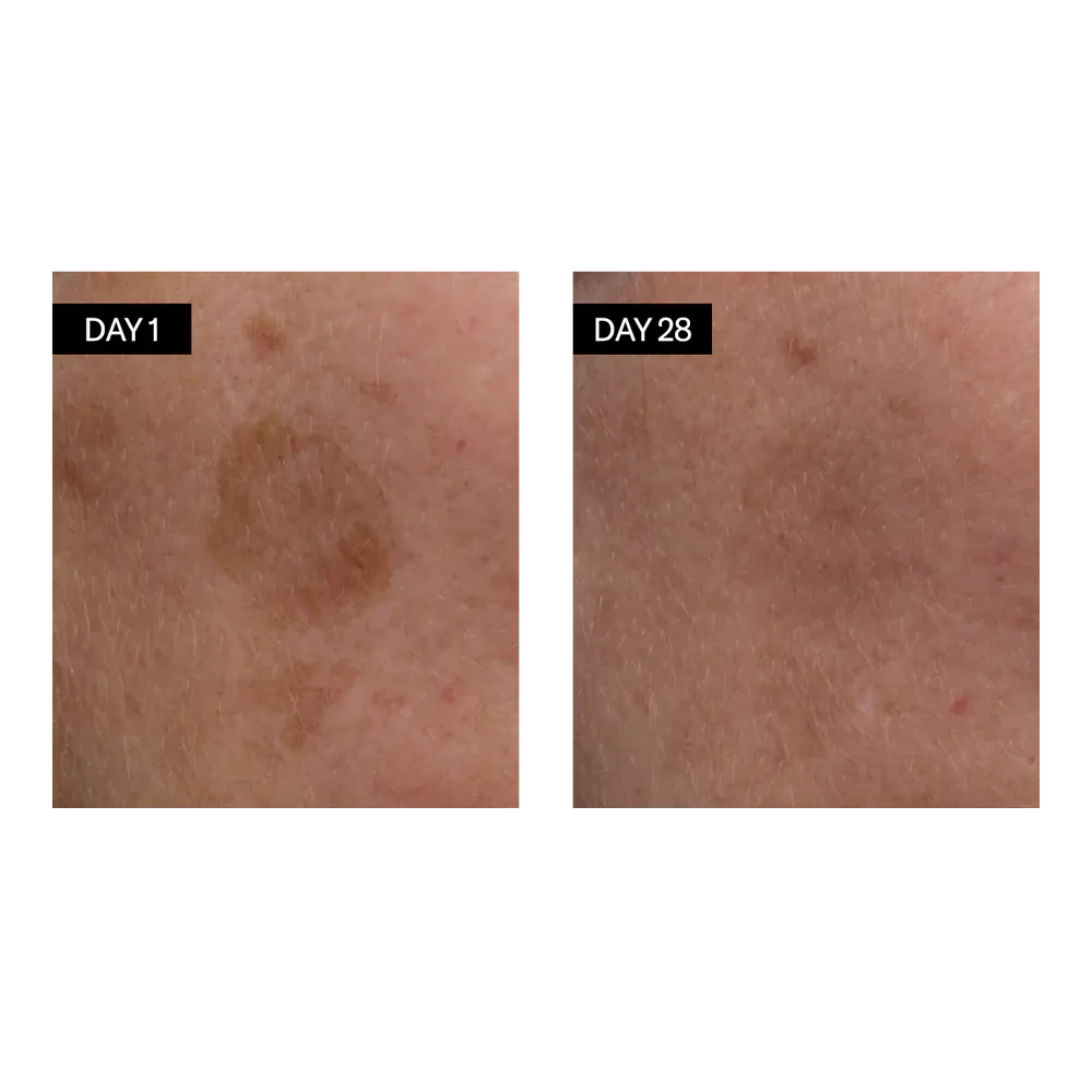 Brightening Serum | Vitamin C & E   Hyaluronic Acid