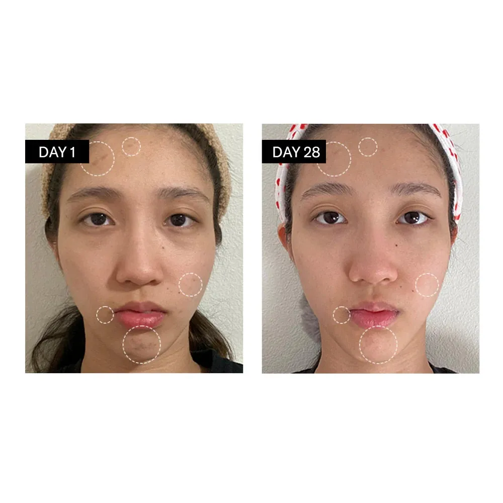 Clarifying Serum | Salicylic   Hyaluronic Acid