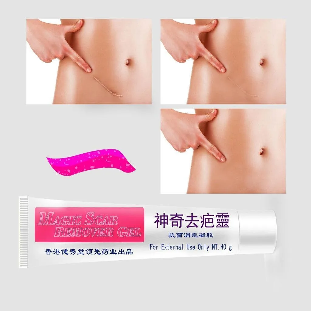 Magic Scar Remover Gel 40g