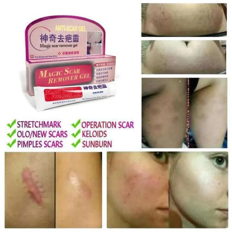 Magic Scar Remover Gel 40g