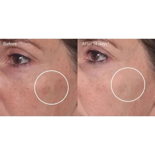 Murad Brighten Trial Kit