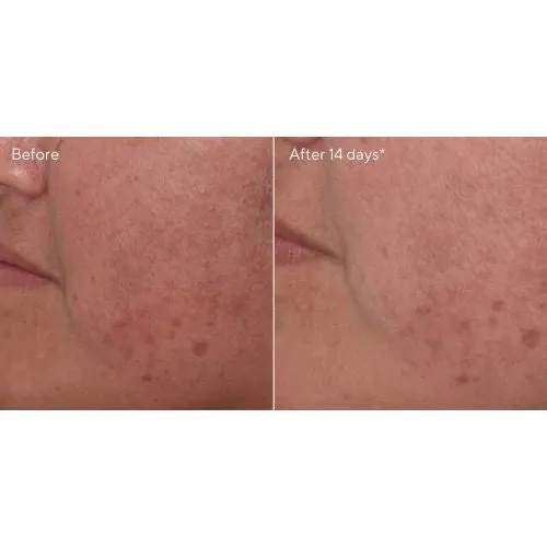 Murad Brighten Trial Kit