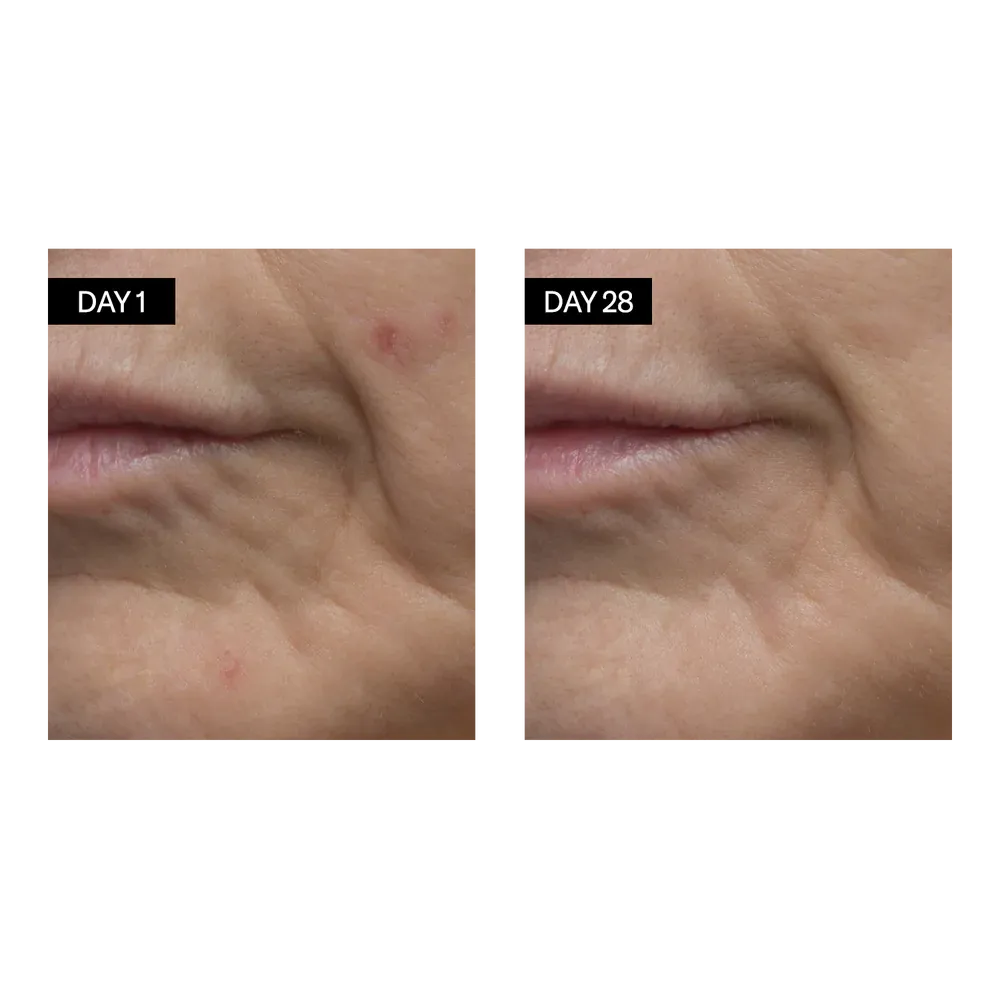 Renewing Serum | Retinol   Hyaluronic Acid