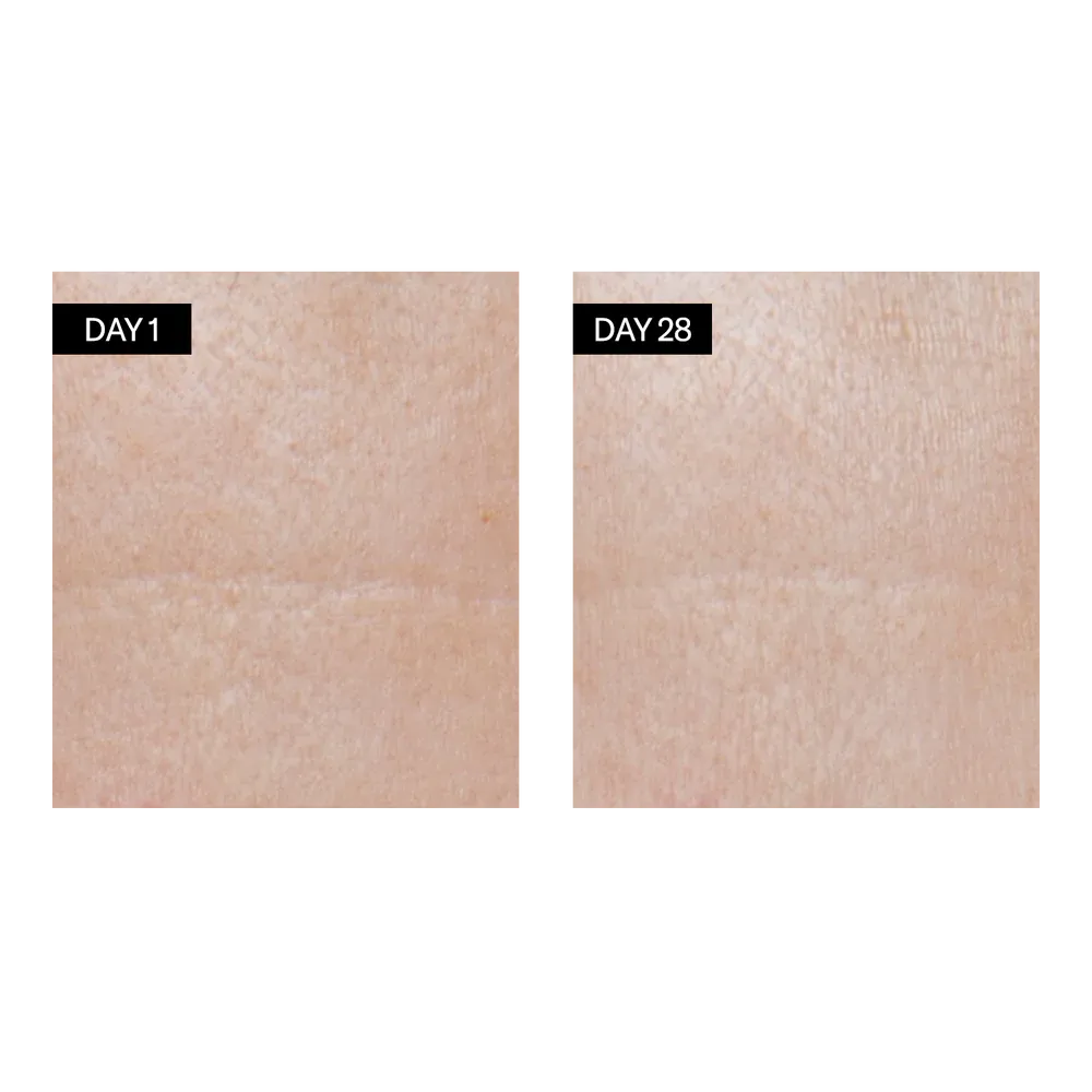 Renewing Serum | Retinol   Hyaluronic Acid