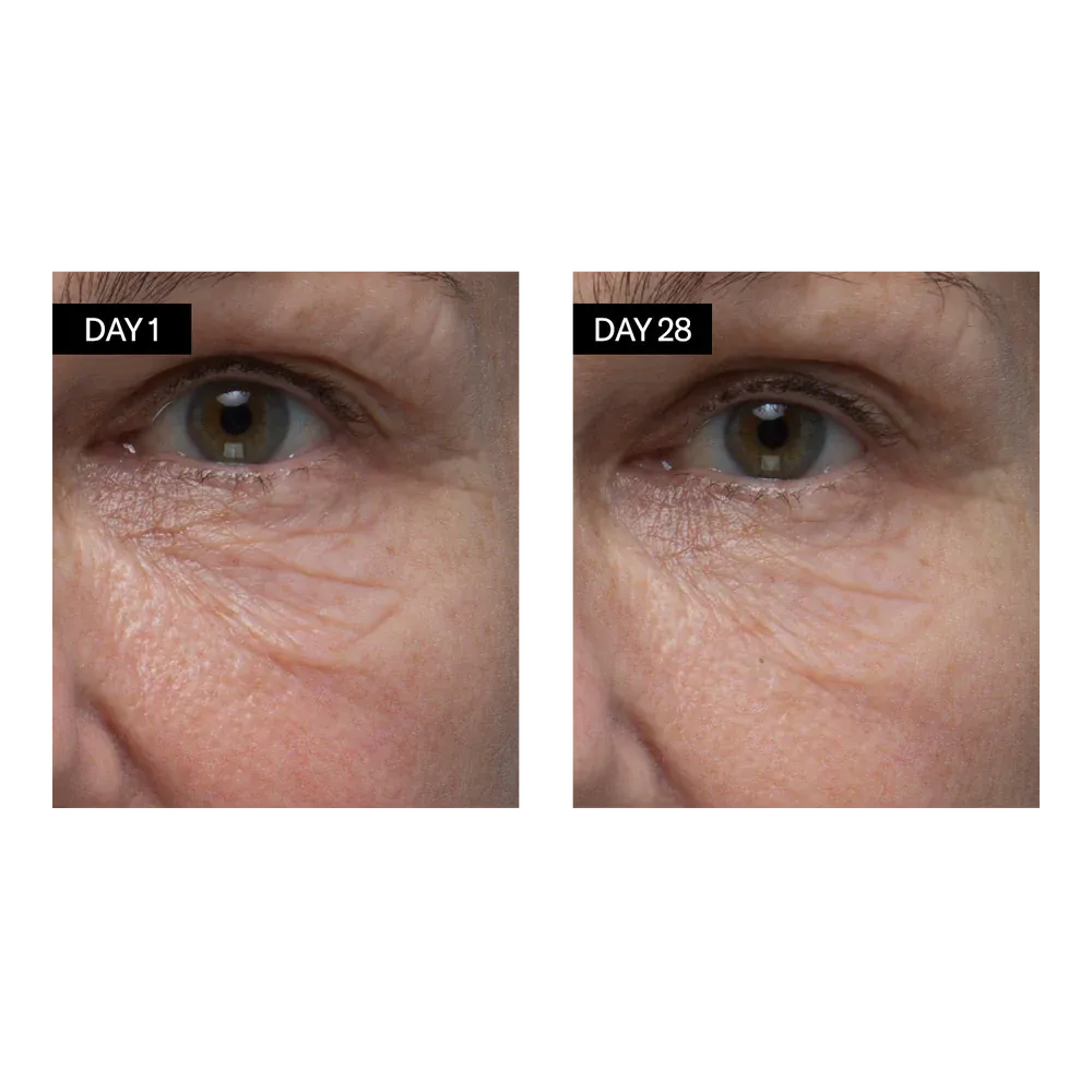 Renewing Serum | Retinol   Hyaluronic Acid