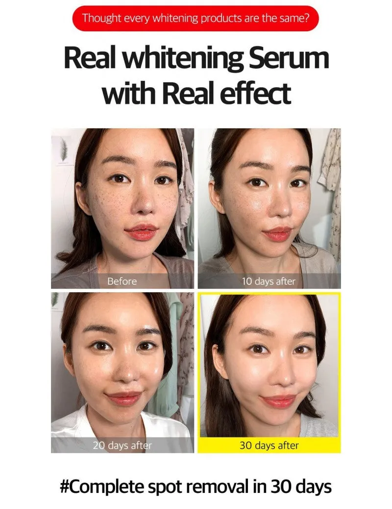 Yuja Niacin 30 Days Blemish Care Serum (50ml)